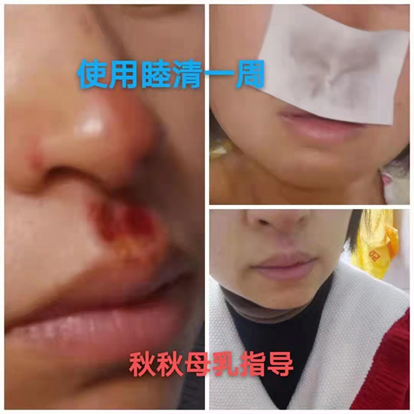 �����澏���N���Æ������M(f��i)�߿ڱ���������(sh��)���a(ch��n)ƷȦ�۟o(w��)��(sh��)