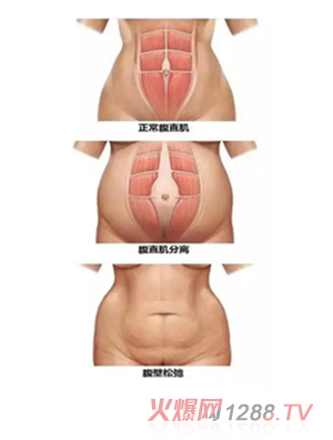 ���������îa(ch��n)���Ŀ-��ֱ���ޏ�