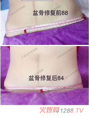 ���������îa(ch��n)���Ŀ-�����ޏ�